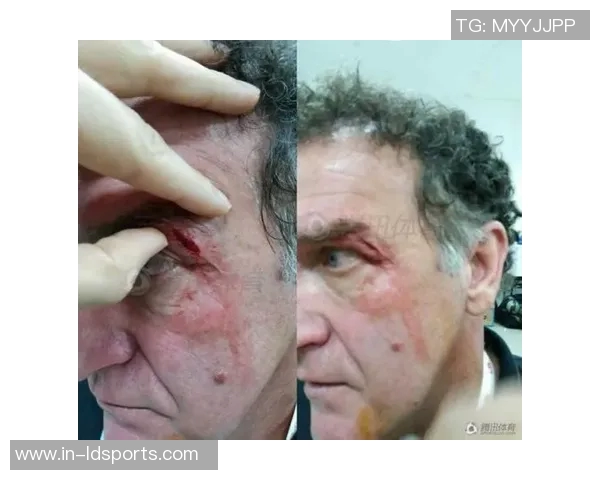 大渡口队球员王耀文因袭击裁判被禁赛五年引发热议